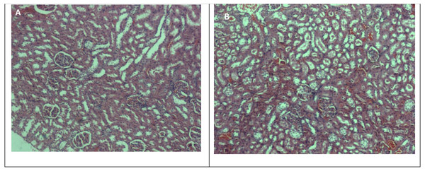 Photomicrographs of kidney sections in rats treated with methanolic extract of A. africanus (H&E stain, magnification ×40).