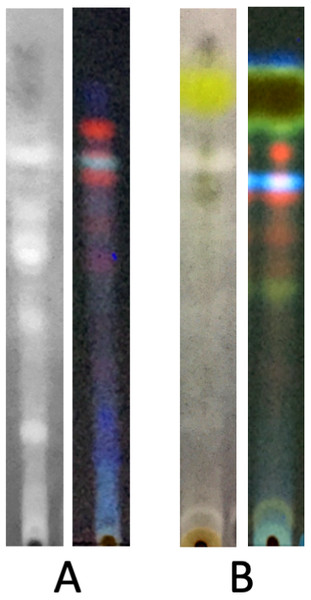 Bioautography assay of the lichen extracts along with TLC profile visualized at 350 nm.