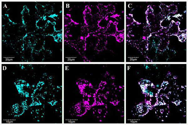 Subcellular localization analysis of PvFAD2 and PvFAD3 in tobacco epidermal cells.