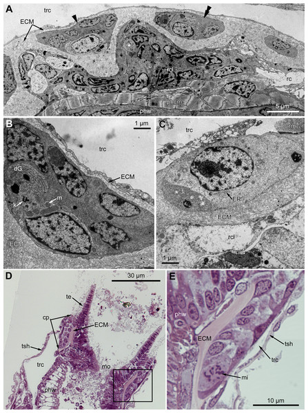 Microanatomy of the proximal region of the ciliated pits in the poypides of the 3rd age class: (A and B), Aquiloniella scabra; (C–E), Rhamhostomella ovata.