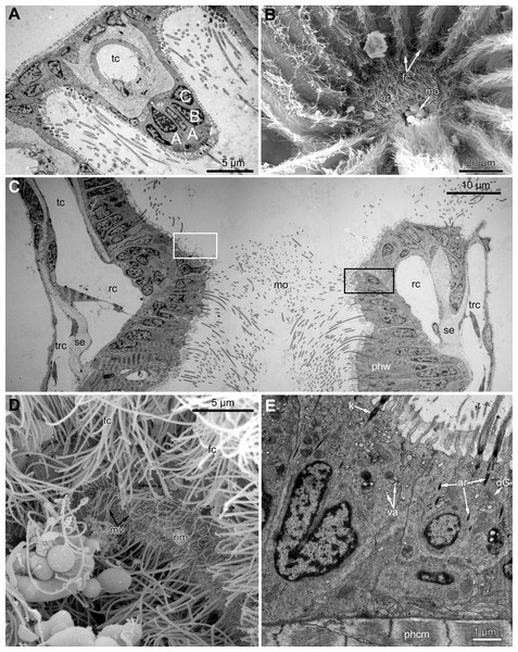 Microanatomy of the oral region: (A–C and E) Aquiloniella scabra; (C and D) Eucratea loricata.