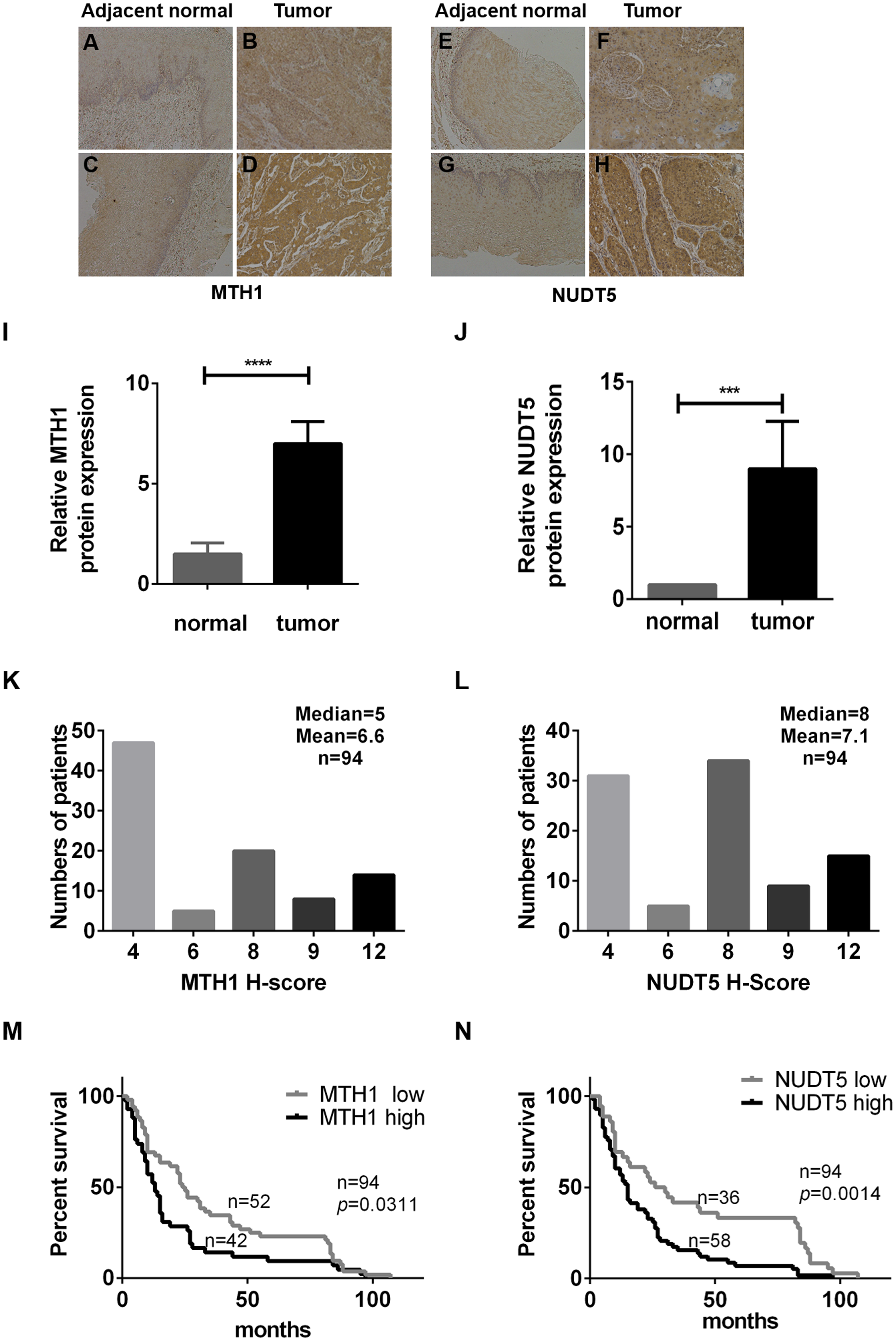 The High Expression Of Mth1 And Nudt5 Predict A Poor Survival And Are Associated With Malignancy Of Esophageal Squamous Cell Carcinoma Peerj