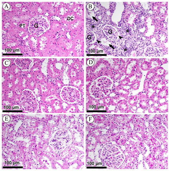 Effect of valsartan and LCZ696 on STZ-induced pathological changes in the kidney as indicated with H&E staining.