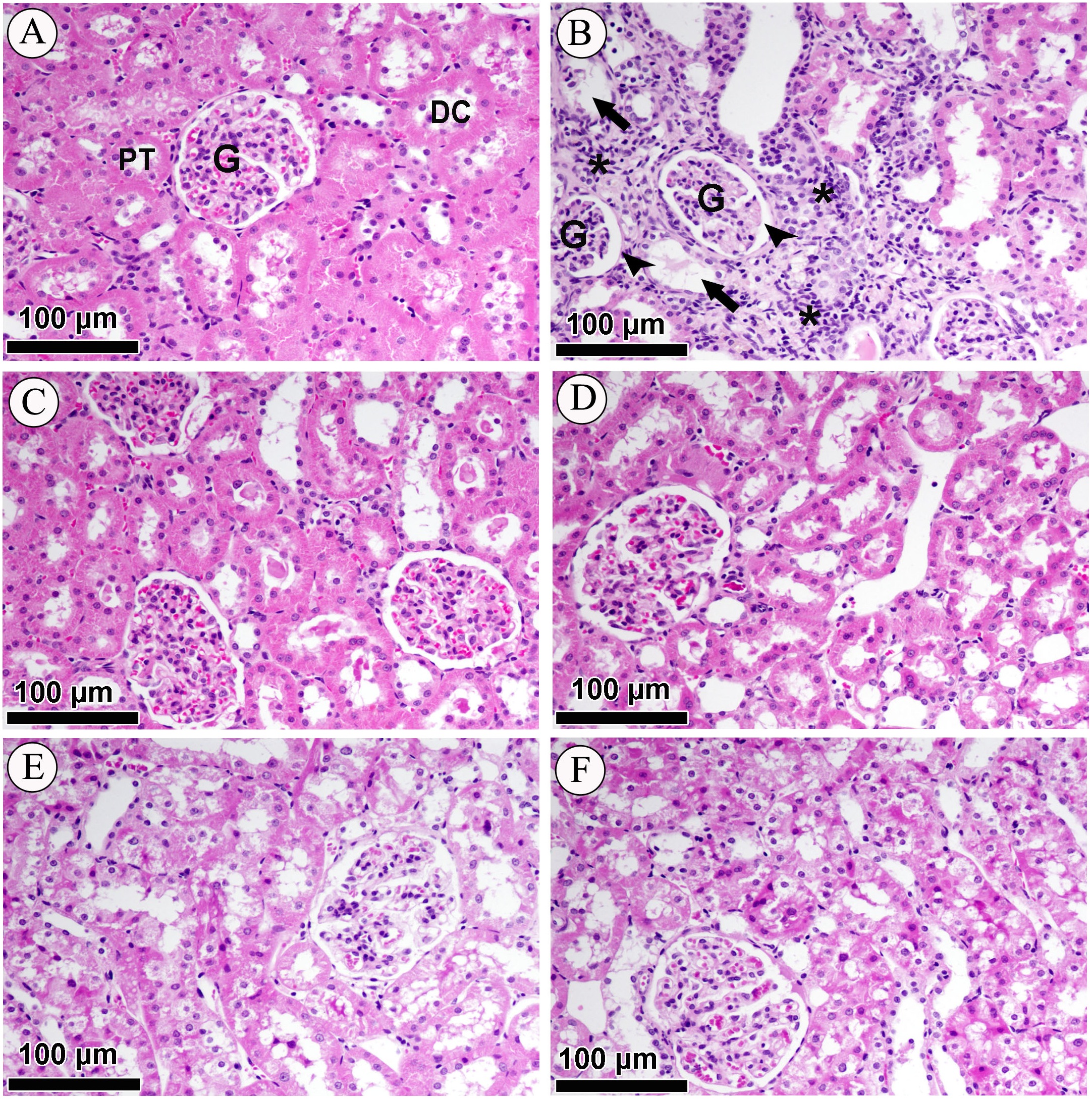 LCZ696 mitigates diabetic-induced nephropathy through inhibiting oxidative  stress, NF-κB mediated inflammation and glomerulosclerosis in rats [PeerJ]