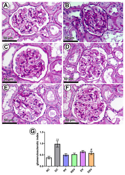 Effect of valsartan and LCZ696 on glomerulosclerosis in diabetic rats.