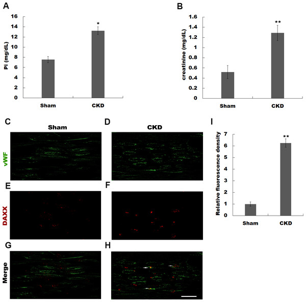 Hyperphosphatemia was correlated with upregulated DAXX expression in endothelial cells.
