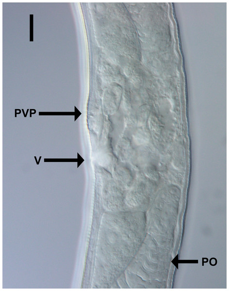 Light micrograph of Chromadorina tangaroa sp. nov.