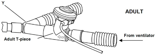 The ventilator circuit.