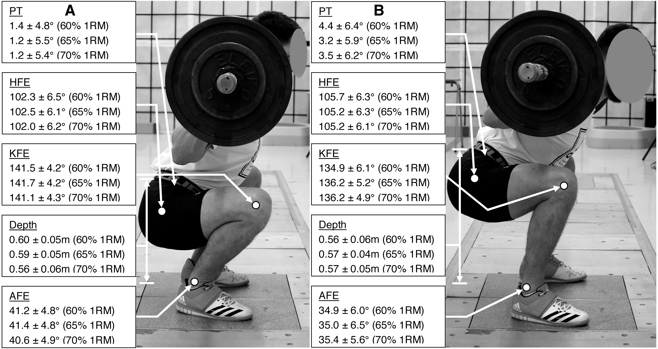 Q&A: Quads vs. Thighs and Full vs. Partial Deadlifts 