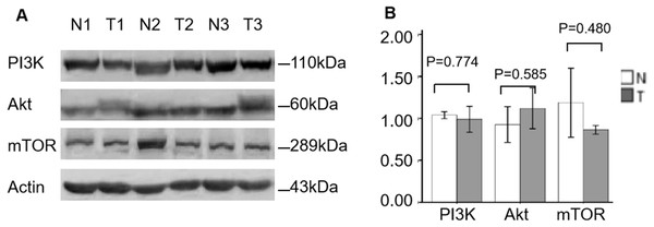 Validation of PI3K, AKT and mTOR protein expression in ccRCC by WB.