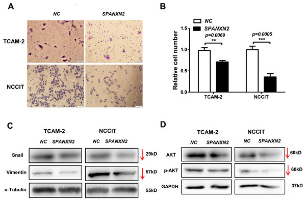 Effects of SPANXN2 on cell migration and the related proteins of EMT and AKT.