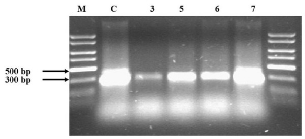 Agarose electrophoresis of Samples 3, 5, 6 and 7, which were not obtained during the first attempt.