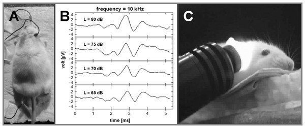 Auditory brainstem recordings.