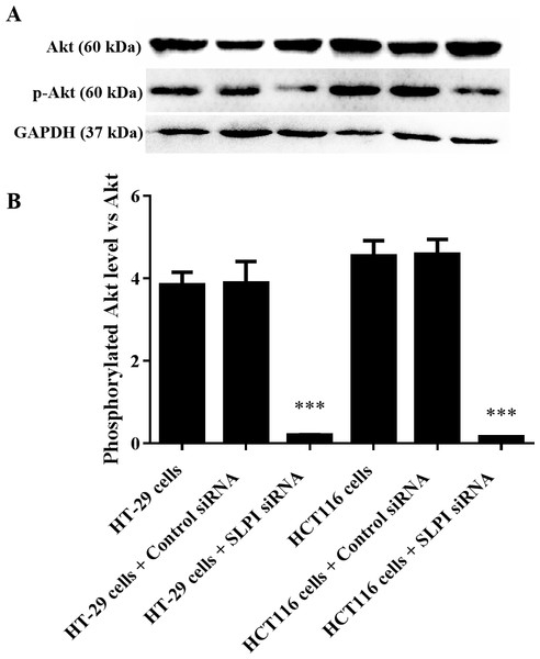 Effect of SLPI knockdown on the activation of AKT in colorectal cancer cells.
