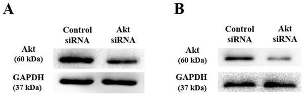 Detection of AKT protein expression after siRNA knockdown in colorectal cancer cell lines HT-29 and HCT116 by Western blotting.