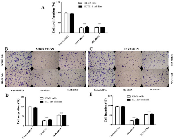 Effect of siRNA-mediated AKT knockdown on the survival, migration and invasion of colorectal cancer cell lines HT29 and HCT116 Proliferation.