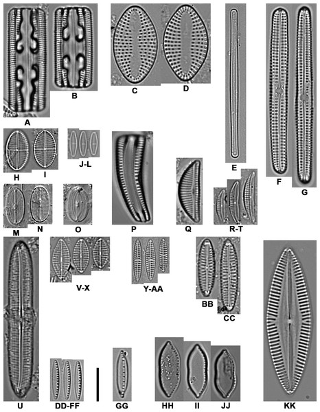 Light microscope images of the most abundant epibiont diatoms associated with Caretta caretta.