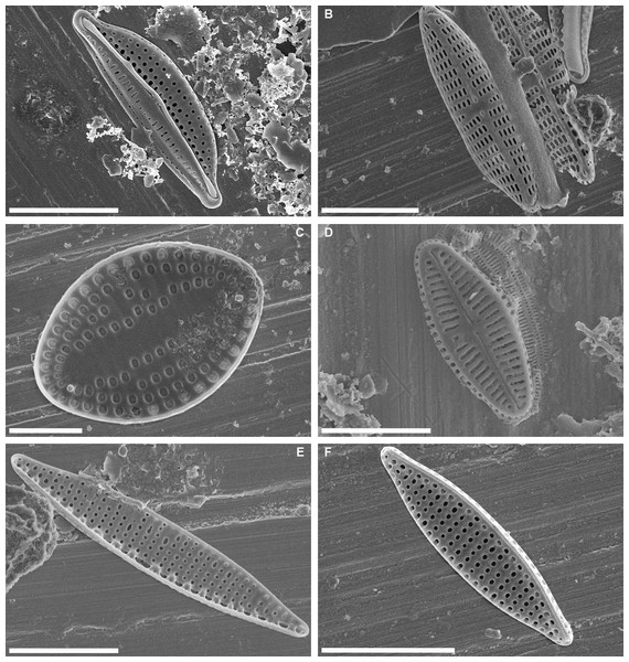 Scanning electron micrographs of some abundant taxa in epibiont diatom assemblages associated with Caretta caretta.