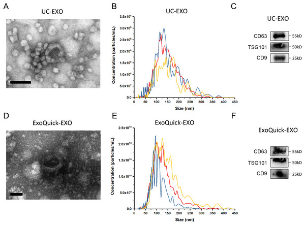  The characterization of exosomes isolated from human serum.