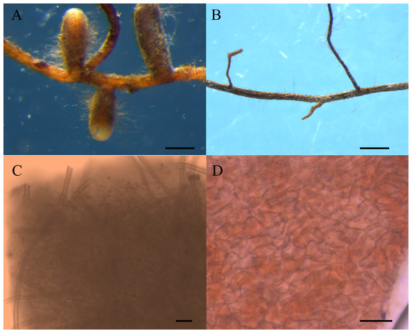 Morphological features of Carya illinoinensis root in association with or without Tuber melanosporum.