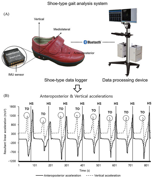 A shoe-type gait analysis system.