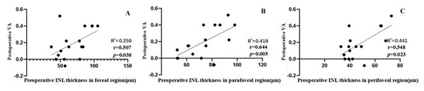 Correlation between postoperative VA at 6 months and the preoperative individual retinal layer thickness in each macular region of 17 patients whose VA gained ≥ 2 lines after an operation.