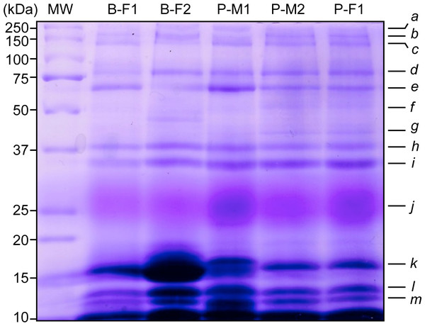 Representative SDS-PAGE-1-D of saliva proteins from five wild black howler monkeys. Protein bands were stained according to Beeley et al. (1991) to reveal potential PRPs.