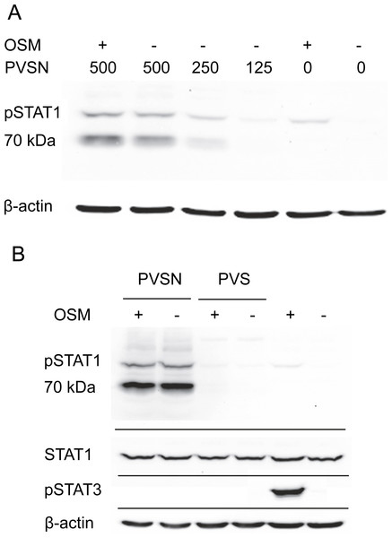 PVSN-induced STAT1 phosphorylation with and without OSM treatment.