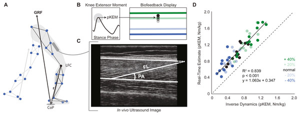 Real-time peak knee extensor moment (pKEM) biofeedback.