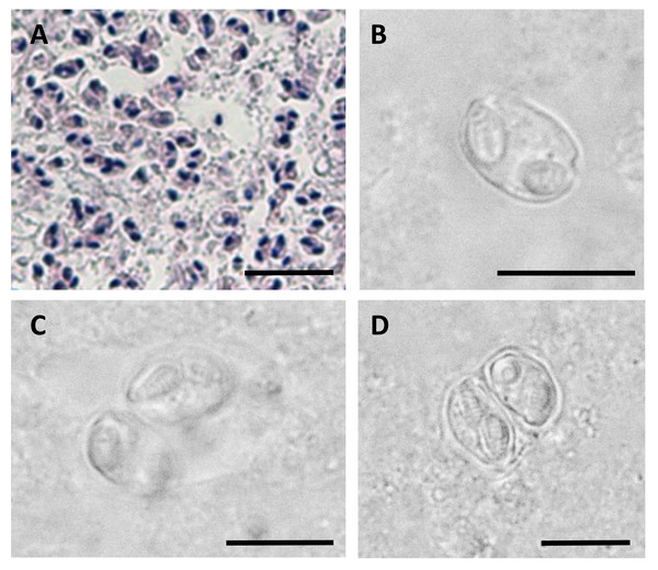 Myxospores of Enteromyxum caesio n. sp.