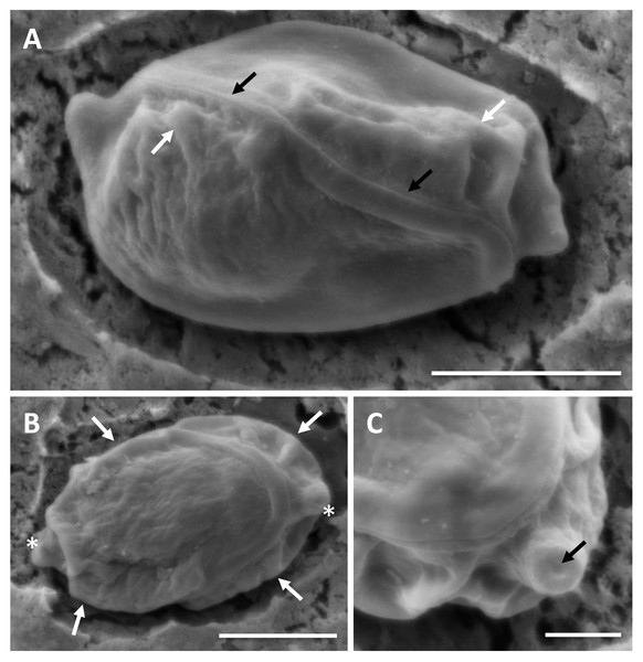 SEM of myxospores of Enteromyxum caesio n. sp.