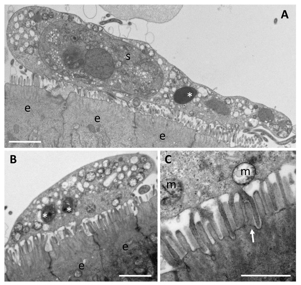 Trophozoites of Enteromyxum fugu, attached to the microvilli of the intestinal lining by pseudopodia.