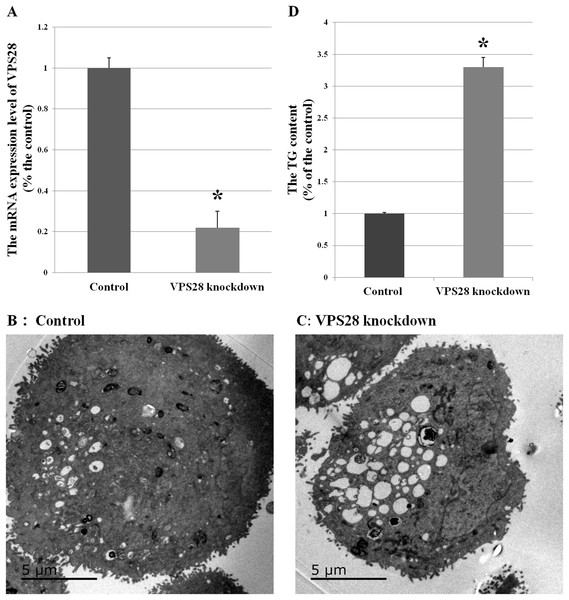 Effects of VPS28 knockdown on BMECs.