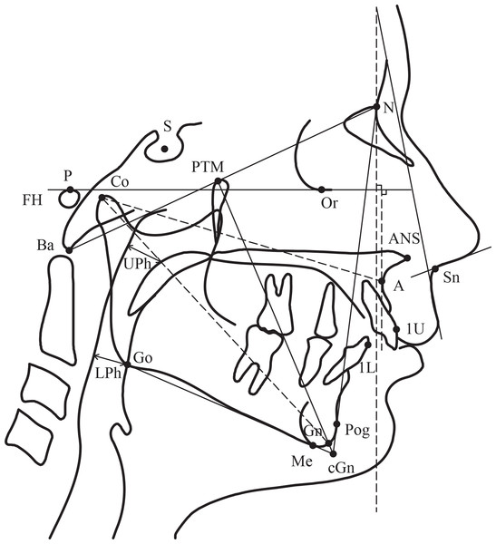 Reference cephalometric landmarks and lines used in this study.