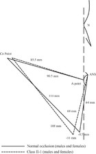 Craniofacial Characteristics Of Syrian Adolescents With Class Ii 