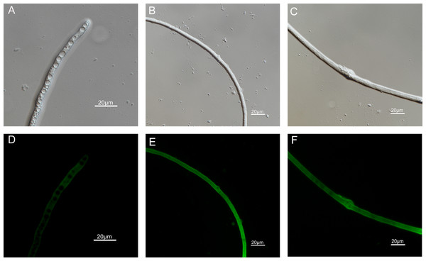 Effects of carvacrol and thymol on ROS measured by fluorescence microscope.