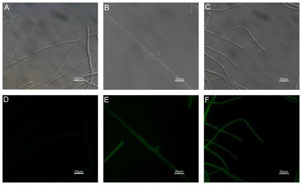 Effects of carvacrol and thymol on plasma membrane integrity measured by fluorescence microscope.