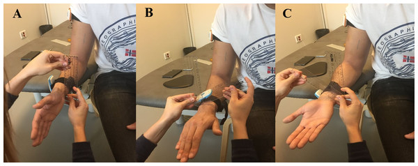 Validity and reliability of inertial sensors for elbow and wrist range ...