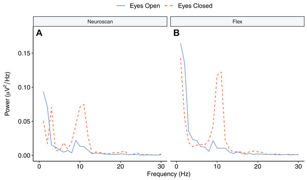 Power spectrum in ‘eyes open’ and ‘eyes closed’ conditions across frequencies (1–30 Hz).