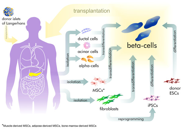 The existing approaches for beta-cell recovery.