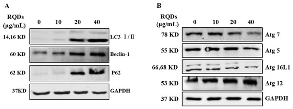 RQDs alter the expression of (A) LC3I/II and (B) modulate autophagy regulatory proteins.