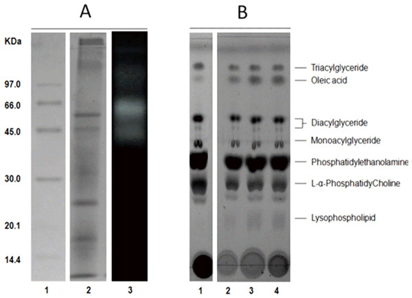 Protein profile electrophoretogram and zymogram from Stomolophus sp. 2 jellyfish gastric pouch extract (A). Thin-layer chromatogram of phospholipid hydrolysis products of digestive lipases from jellyfish (B).