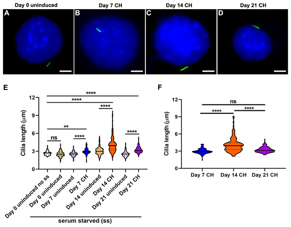 Chondrogenic differentiation causes elongation of primary cilia in ATDC5 cells.