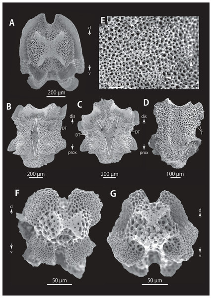 Astrocladus dofleini (NSMT E-13124). SEM photographs of ossicles.