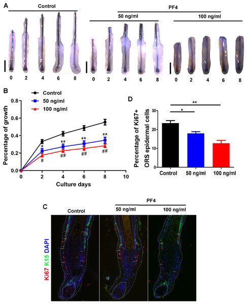 PF4 suppresses the elongation of hair shaft in cultured human hair follicles.