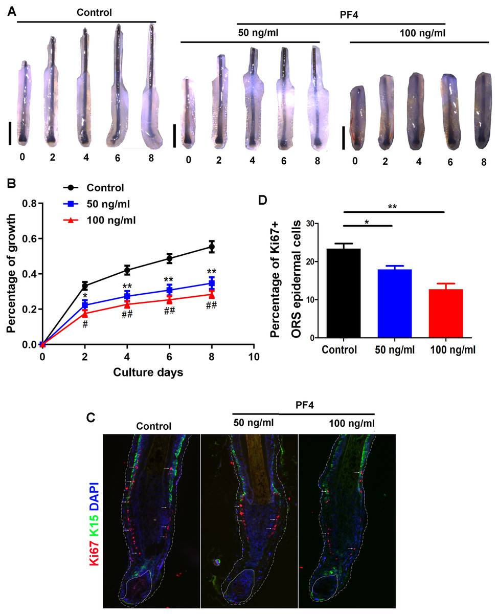 Platelet factor 4 inhibits human hair follicle growth and promotes androgen  receptor expression in human dermal papilla cells [PeerJ]