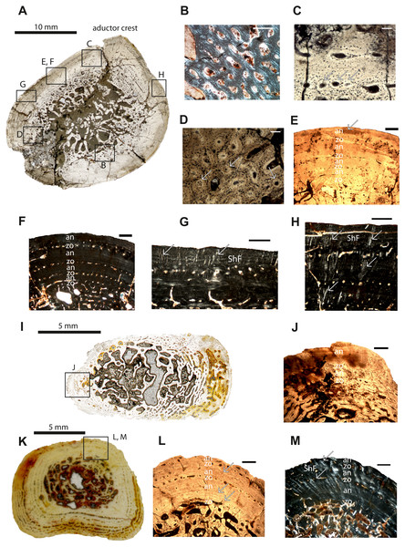 Microstructure and histology of the femur, ulna and tibia of Panthasaurus maleriensis.