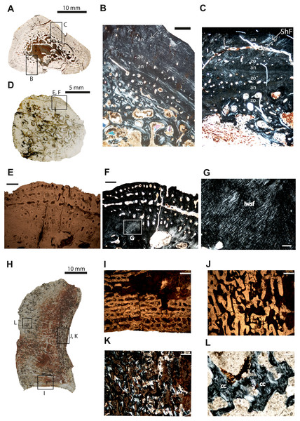 Microstructure and histology of the rib, ilium and intercentrum of Panthasaurus maleriensis.