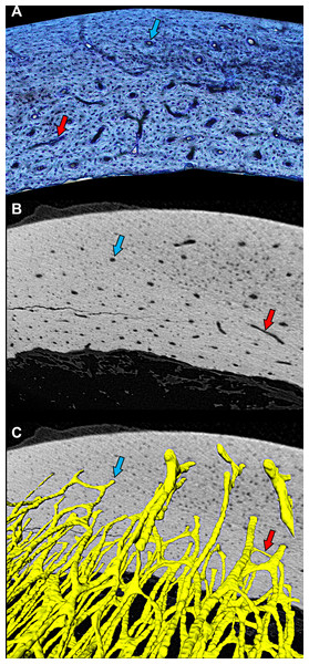 Cross-sectional profile of a primary vascular canal is a useful approximation for canal orientation.