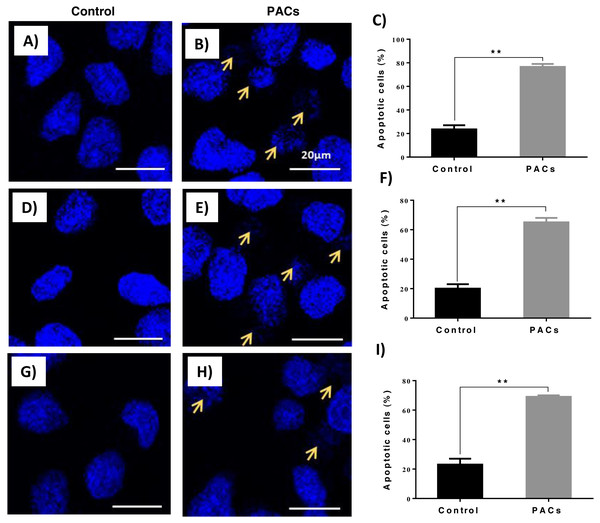 Apoptotic nucleus morphology in HT29, MCF-7, and PC-3 cells after PACs treatment.